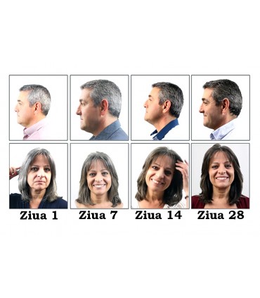 Teste pe par femei si barbati pentru  Solutia Ultra pentru repigmentare par alb sau grizonat. Phytema. www.dermapil.ro